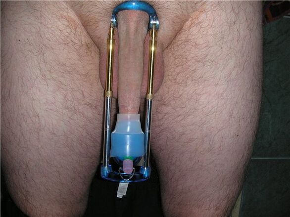 Penis enlargement device