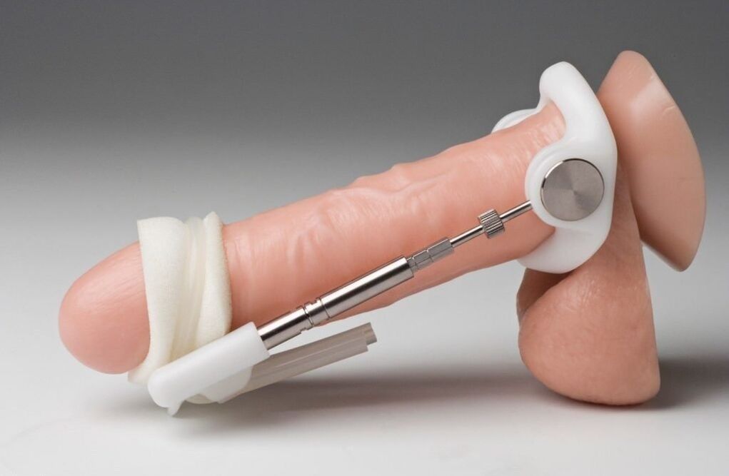 The expanded person to increase the thickness of the penis